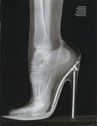 High Heel X-Ray