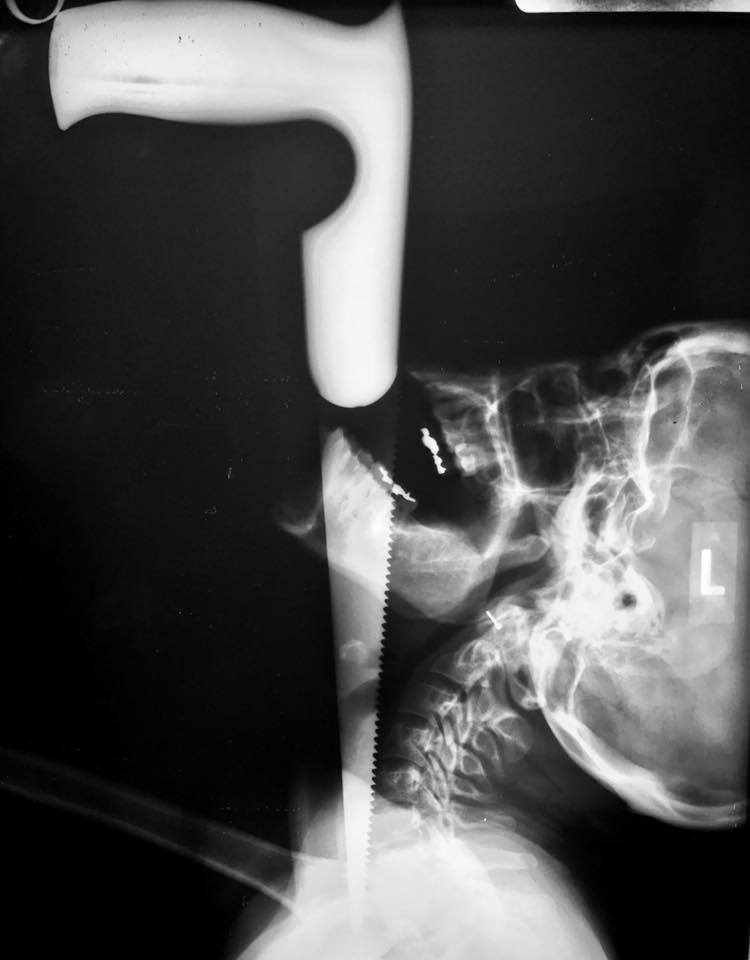 Bored Chiropractor X-ray